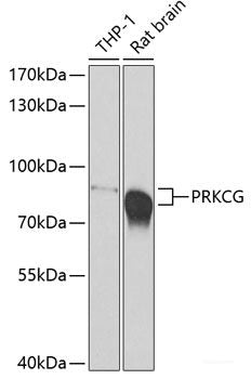 Immunofluorescence analysis of U2OS cells using HOXB5 Polyclonal Antibody at dilution of  1:100. Blue: DAPI for nuclear staining.