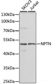 Immunohistochemistry of paraffin-embedded Human stomach using STX16 Polyclonal Antibody at dilution of  1:100 (40x lens).