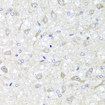 Immunohistochemistry of paraffin-embedded Human stomach using MRPS22 Polyclonal Antibody at dilution of  1:100 (40x lens).