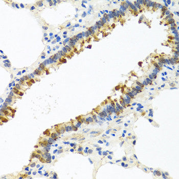 Immunohistochemistry of paraffin-embedded Human esophagus using GRPEL2 Polyclonal Antibody at dilution of  1:100 (40x lens).