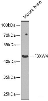 Immunohistochemistry of paraffin-embedded Rat lung using ANKRD52 Polyclonal Antibody at dilution of  1:100 (40x lens).