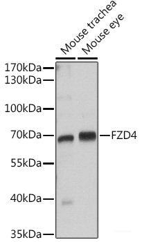 Immunohistochemistry of paraffin-embedded Human stomach using ALAD Polyclonal Antibody at dilution of  1:100 (40x lens).
