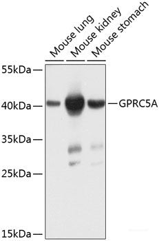 Immunohistochemistry of paraffin-embedded Human stomach using CTSC Polyclonal Antibody at dilution of  1:100 (40x lens).