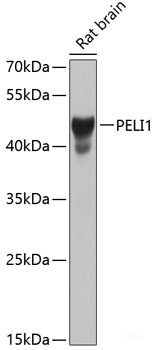Immunohistochemistry of paraffin-embedded Human stomach using PER1 Polyclonal Antibody at dilution of  1:100 (40x lens).