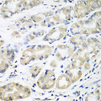 Immunohistochemistry of paraffin-embedded Rat lung using PRDM2 Polyclonal Antibody at dilution of  1:100 (40x lens).