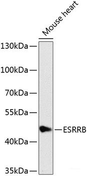 Immunohistochemistry of paraffin-embedded Rat testis using HFM1 Polyclonal Antibody at dilution of  1:100 (40x lens).