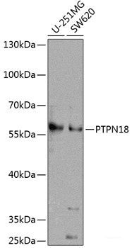 Immunofluorescence analysis of C6 cells using MCTS1 Polyclonal Antibody at dilution of  1:100 (40x lens). Blue: DAPI for nuclear staining.