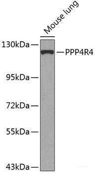 Immunohistochemistry of paraffin-embedded Rat lung using RPL22 Polyclonal Antibody at dilution of  1:100 (40x lens).