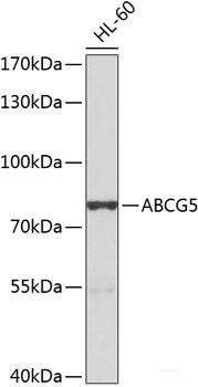 Immunohistochemistry of paraffin-embedded Rat liver using PHOX2B Polyclonal Antibody at dilution of  1:100 (40x lens).