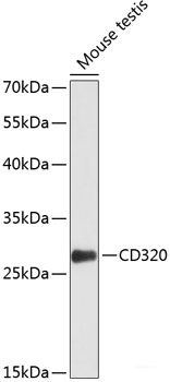 Immunohistochemistry of paraffin-embedded Human prostate using MTERFD1 Polyclonal Antibody at dilution of  1:100 (40x lens).