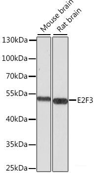 Immunohistochemistry of paraffin-embedded Mouse kidney using AIP Polyclonal Antibody at dilution of  1:100 (40x lens).