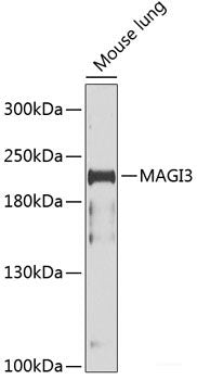 Western blot analysis of extracts of HT-29 cells using Phospho-BRCA1(S1423) Polyclonal Antibody at dilution of 1:2000. HT-29 cells were treated by Anisomycin (5ug/ml) for 30 minutes after serum-starvation overnight.