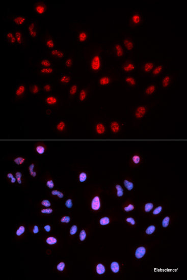Immunohistochemistry of paraffin-embedded Rat lung using Phospho-ERK1（T202/Y204）/ ERK2（T185/Y187） Polyclonal Antibody at dilution of  1:100 (40x lens).