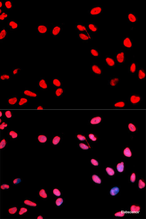 Immunohistochemistry of paraffin-embedded Rat lung using Phospho-Stat3(S727) Polyclonal Antibody at dilution of  1:100 (40x lens).