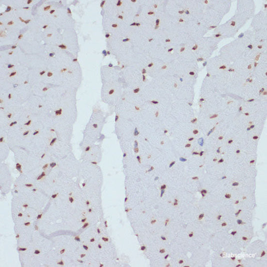 Western blot analysis of extracts of NIH/3T3-Src cells using Phospho-SRC Family（Y416） Polyclonal Antibody.