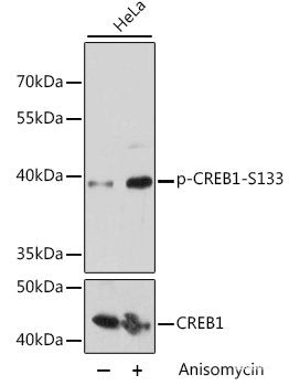 Western blot analysis of extracts of Jurkat cells using Phospho-SRC Family（Y416） Polyclonal Antibody at dilution of 1:1000.