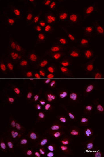 Western blot analysis of extracts of Jurkat cells using Phospho-Syk（Y352）/ZAP70（Y319） Polyclonal Antibody at dilution of 1:1000.