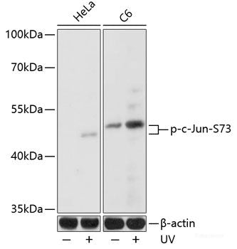 Immunohistochemistry of paraffin-embedded Rat brain using Phospho-ATF2(T69/T71) Polyclonal Antibody at dilution of  1:100 (40x lens).