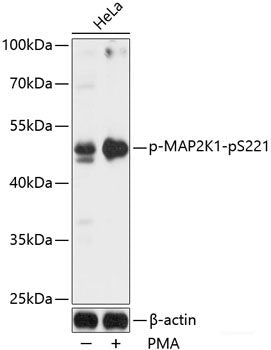 Western blot analysis of extracts of HeLa cells using Phospho-Smad2（S465/467）/Smad3（S423/425) Polyclonal Antibody at dilution of 1:1000.