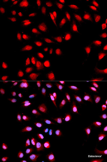 Immunohistochemistry of paraffin-embedded Mouse heart using Phospho-P70 S6K(T389) Polyclonal Antibody at dilution of  1:100 (40x lens).