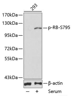 Immunohistochemistry of paraffin-embedded Rat lung using Phospho-PEA15(S104) Polyclonal Antibody at dilution of  1:100 (40x lens).