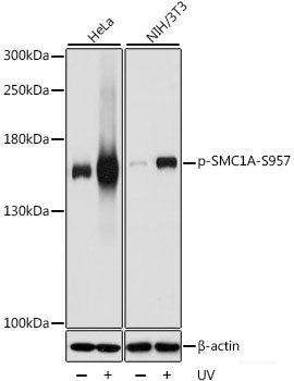 Immunohistochemistry of paraffin-embedded Human appendix using Phospho-PLN(T17) Polyclonal Antibody at dilution of  1:100 (40x lens).