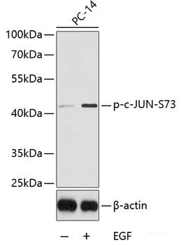 Immunohistochemistry of paraffin-embedded Rat kidney using Phospho-ABL1(Y412) Polyclonal Antibody at dilution of  1:100 (40x lens).