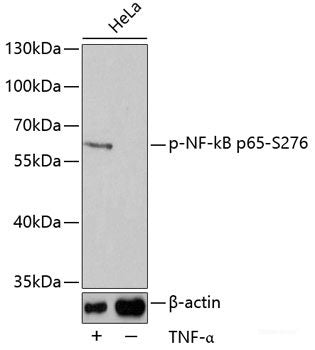 Immunohistochemistry of paraffin-embedded Rat liver using Phospho-Histone H2A(S129) Polyclonal Antibody at dilution of  1:100 (40x lens).