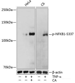 Immunohistochemistry analysis of paraffin-embedded human orchidoncus  using Cyclin E1 Polyclonal Antibody at dilution of 1:400.