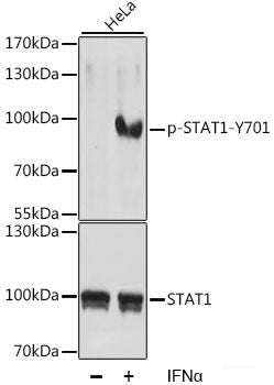 Immunohistochemistry analysis of paraffin-embedded human Tonsil  using AIFM1 Polyclonal Antibody at dilution of 1:400.