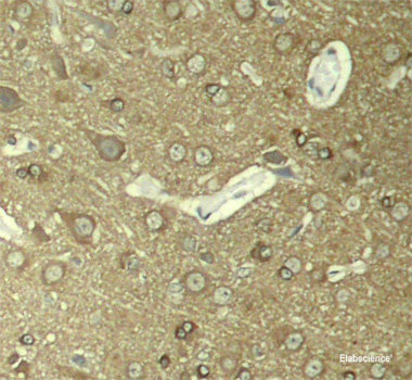 Immunohistochemistry analysis of paraffin-embedded mouse bone  using TNFRSF11B Polyclonal Antibody at dilution of 1:200.