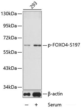 Immunohistochemistry analysis of paraffin-embedded mouse brain  using DCX Polyclonal Antibody at dilution of 1:400.