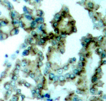 Immunohistochemistry analysis of paraffin-embedded human colon  using MUC2 Polyclonal Antibody at dilution of 1:600.
