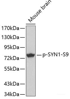Western Blot analysis of various samples using control peptide antigen (left) and CCR7 Polyclonal Antibody at dilution of 1:800(right).