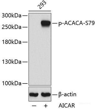 Immunohistochemistry analysis of paraffin-embedded mouse spleen  using SOCS1 Polyclonal Antibody at dilution of 1:300.