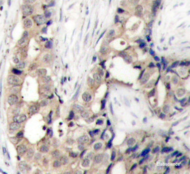 Immunohistochemistry analysis of paraffin-embedded rat lymph node  using BAG2 Polyclonal Antibody at dilution of 1:400.