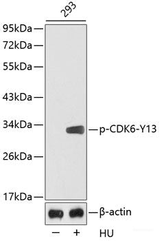 Western Blot analysis of various samples using CD54 Polyclonal Antibody at dilution of 1:1000.