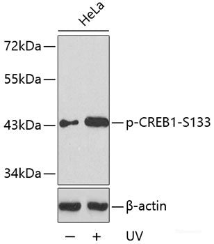 Immunohistochemistry analysis of paraffin-embedded mouse bone  using BGLAP Polyclonal Antibody at dilution of 1:100.