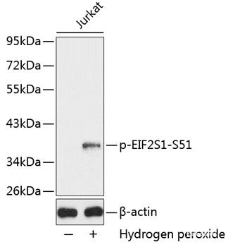 Immunohistochemistry analysis of paraffin-embedded human Prostate  using AR Polyclonal Antibody at dilution of 1:300.