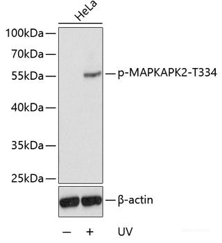 Immunohistochemistry analysis of paraffin-embedded mouse Immunized spleen  using S100A8 Polyclonal Antibody at dilution of 1:400.