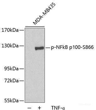 Immunohistochemistry analysis of paraffin-embedded mouse inflammatory spleen  using IL2 Polyclonal Antibody at dilution of 1:500.