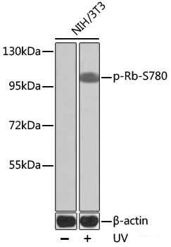 Immunohistochemistry analysis of paraffin-embedded Rat skeletal muscle   using CD31 Monoclonal Antibody at dilution of 1:200.