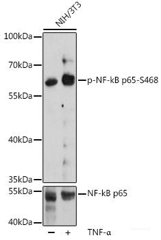 Immunohistochemistry analysis of paraffin-embedded human colon cancer  using JMJD6 Polyclonal Antibody at dilution of 1:1000.