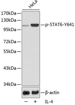 Immunohistochemistry analysis of paraffin-embedded human colon  using Claudin 5 Polyclonal Antibody at dilution of 1:400.