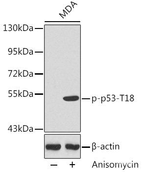 Immunohistochemistry analysis of paraffin-embedded mouse kidney  using BRAF Polyclonal Antibody at dilution of 1:400.