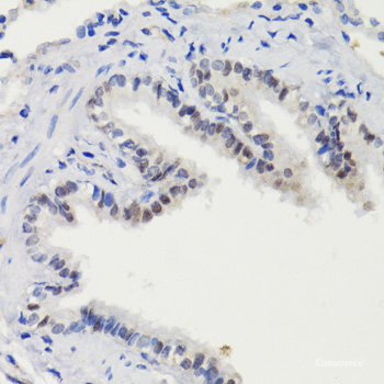 Immunohistochemistry analysis of paraffin-embedded Human tonsil  using p21 Polyclonal Antibody at dilution of 1:300.