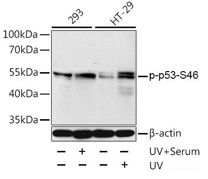 Immunohistochemistry analysis of paraffin-embedded mouse jejunum(intraperitoneal injection BrdU every 2 hours for 4 times)  using Brdu Monoclonal Antibody at dilution of 1:300.