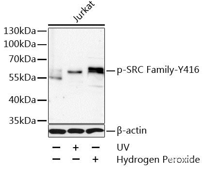 Immunohistochemistry analysis of paraffin-embedded rat cortex  using TAC1 Polyclonal Antibody at dilution of 1:300.