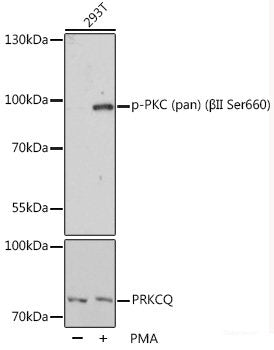 Immunohistochemistry analysis of paraffin-embedded human lung cancer   using NFKBIB Polyclonal Antibody at dilution of 1:300.