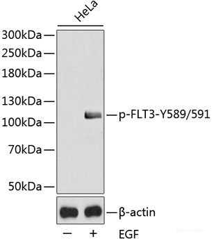Immunohistochemistry analysis of paraffin-embedded human lymphoma  using UCP2 Polyclonal Antibody at dilution of 1:300.